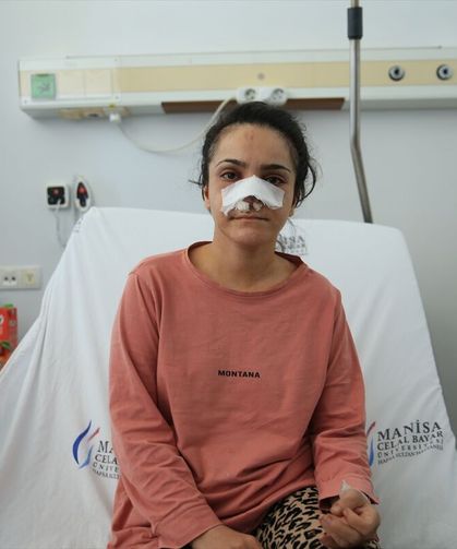 Tartıştığı eşinin burnunu ısırarak kopardı
