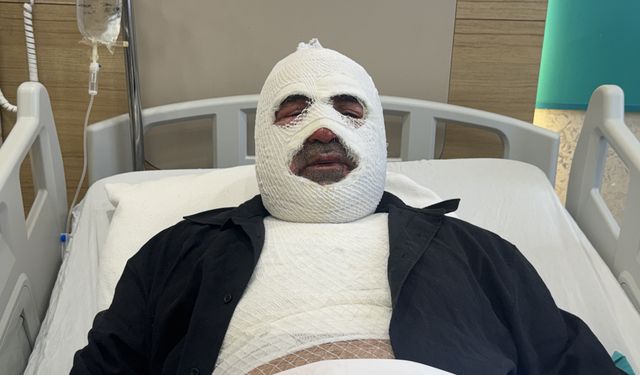 Hararet yapan araca acele müdahale ikinci derece yanığa neden oldu
