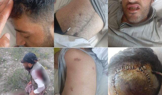 Van’da iki çobana pusu kuruldu